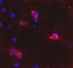 mGluR6 Antibody in Immunocytochemistry (ICC/IF)