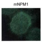 NPM1 (mutant) Antibody in Immunocytochemistry (ICC/IF)