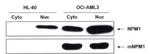 NPM1 (mutant) Antibody in Western Blot (WB)