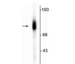 Dopamine beta Hydroxylase Antibody in Western Blot (WB)