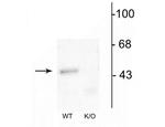 GABRA1 Antibody in Western Blot (WB)