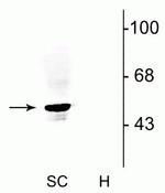 GLRA1 Antibody in Western Blot (WB)