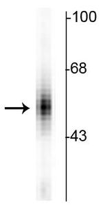 TPH1 Antibody in Western Blot (WB)