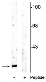 Phospho-alpha Synuclein (Ser129) Antibody in Western Blot (WB)