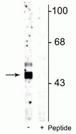 Phospho-GSK3B (Ser9) Antibody in Western Blot (WB)