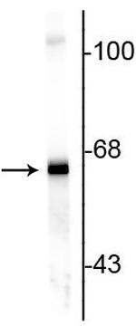 alpha Internexin Antibody in Western Blot (WB)