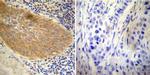 Glucocorticoid Receptor Antibody in Immunohistochemistry (Paraffin) (IHC (P))