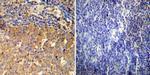 Glucocorticoid Receptor Antibody in Immunohistochemistry (Paraffin) (IHC (P))