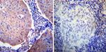 Glucocorticoid Receptor alpha Antibody in Immunohistochemistry (Paraffin) (IHC (P))