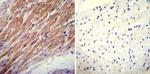 Glucocorticoid Receptor alpha Antibody in Immunohistochemistry (Paraffin) (IHC (P))