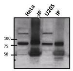 ATRIP Antibody in Immunoprecipitation (IP)