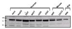 ATRIP Antibody in Western Blot (WB)