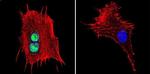 ATRIP Antibody in Immunocytochemistry (ICC/IF)