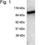 PDE6A Antibody in Western Blot (WB)