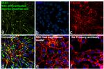 SAP97 Antibody in Immunocytochemistry (ICC/IF)