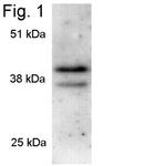 PAR4 Antibody in Western Blot (WB)