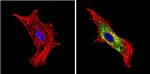 BACE1 Antibody in Immunocytochemistry (ICC/IF)