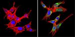 VAMP3 Antibody in Immunocytochemistry (ICC/IF)