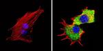 TPH1 Antibody in Immunocytochemistry (ICC/IF)