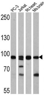 FOXO3A Antibody in Western Blot (WB)