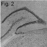 SRC1 Antibody in Immunohistochemistry (IHC)