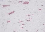 CCL5 (RANTES) Antibody in Immunohistochemistry (Paraffin) (IHC (P))