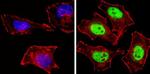 NCoR2 Antibody in Immunocytochemistry (ICC/IF)