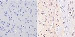 NCoR2 Antibody in Immunohistochemistry (Paraffin) (IHC (P))