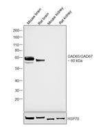 GAD65/GAD67 Antibody in Western Blot (WB)