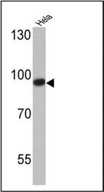 DNMT3B Antibody in Western Blot (WB)