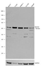 MECP2 Antibody in Western Blot (WB)