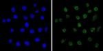 MECP2 Antibody in Immunocytochemistry (ICC/IF)