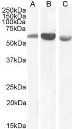 Golgi protein 58k Antibody in Western Blot (WB)