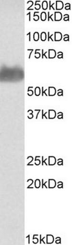 Golgi protein 58k Antibody in Western Blot (WB)