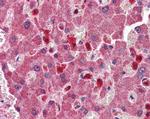 PYCARD Antibody in Immunohistochemistry (Paraffin) (IHC (P))