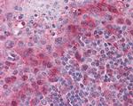 PYCARD Antibody in Immunohistochemistry (Paraffin) (IHC (P))