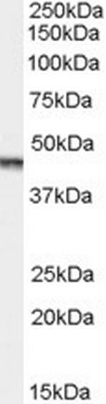 Aurora A Antibody in Western Blot (WB)