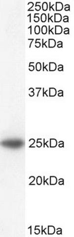 BAK Antibody in Western Blot (WB)