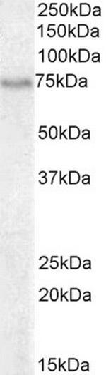 BLNK Antibody in Western Blot (WB)