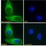 Caveolin 1 Antibody in Immunocytochemistry (ICC/IF)