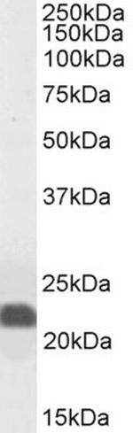 Caveolin 1 Antibody in Western Blot (WB)