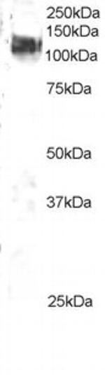 c-Cbl Antibody in Western Blot (WB)