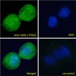 COX2 Antibody in Immunocytochemistry (ICC/IF)