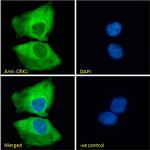 CrkL Antibody in Immunocytochemistry (ICC/IF)