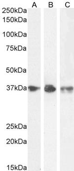 CrkL Antibody in Western Blot (WB)