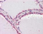 DAPK2 Antibody in Immunohistochemistry (Paraffin) (IHC (P))