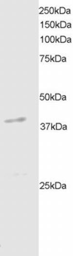 DAPK2 Antibody in Western Blot (WB)