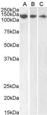 DDB1 Antibody in Western Blot (WB)