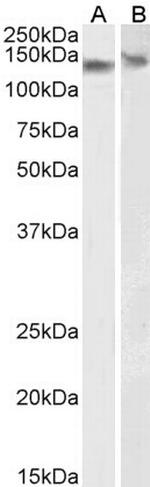 DDB1 Antibody in Western Blot (WB)