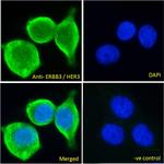 ErbB3 Antibody in Immunocytochemistry (ICC/IF)